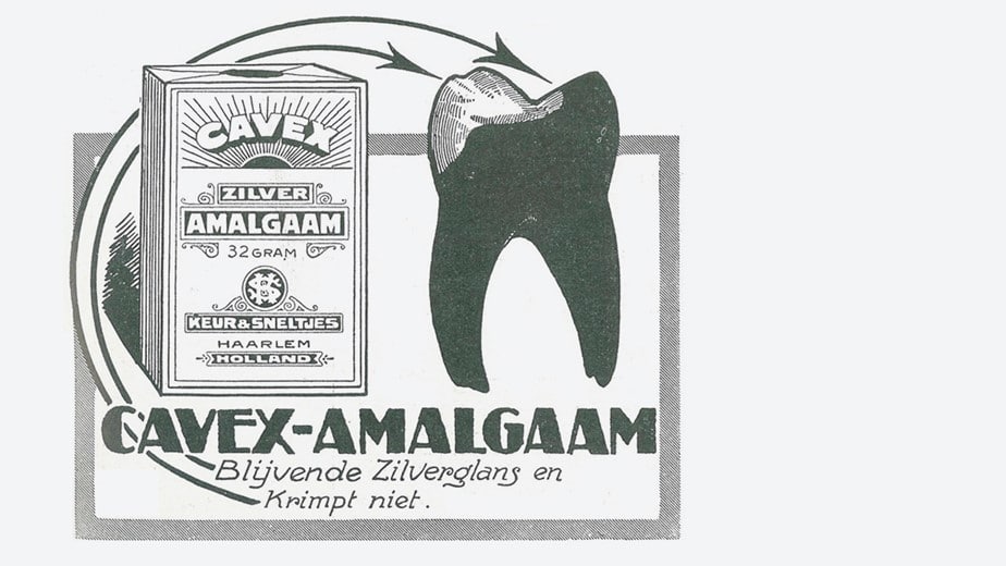 Cavex Amalgam Cavex Amalgam